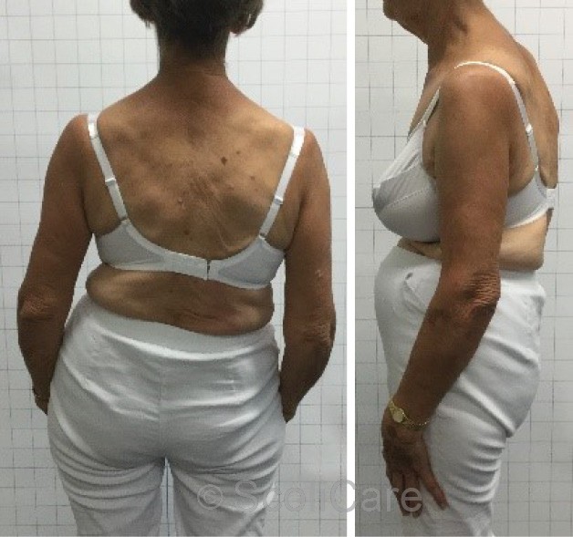 Posteroanterior postural photograph (Left), Lateral postural photograph (Right).