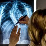 Chiropractic And Scoliosis Care Scoliosis Center Of Utah