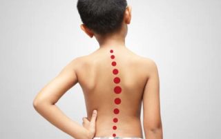 Can Scoliosis Be Treated At Any Age?