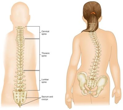Scoliosis 26 – 55 Years