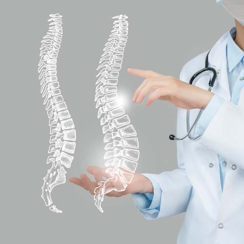 What Happens if You Let Scoliosis Go Untreated?