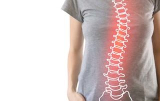 Am I Stuck With Scoliosis?