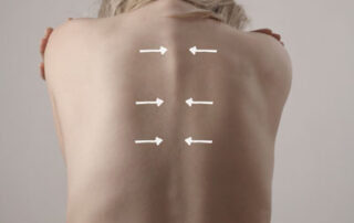 Clearing Up the Myths and Risks Surrounding Scoliosis Bracing