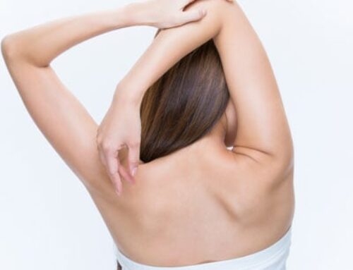 Can Scoliosis Come Back After Being Corrected Naturally?