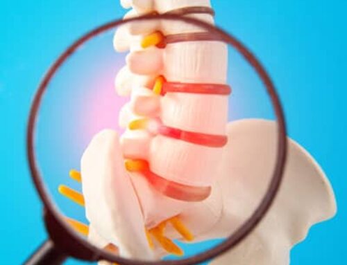 Comprehensive Guide to Scoliosis Treatment Options
