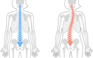 Chiropractic Care for Scoliosis and Posture Correction