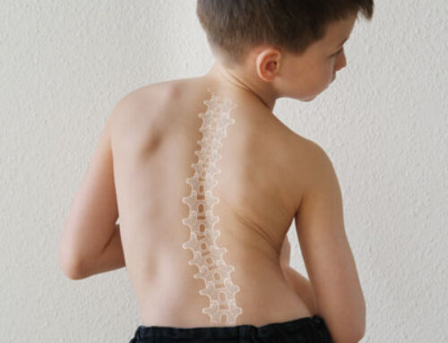 Scoliosis in Children: Early Detection and Intervention