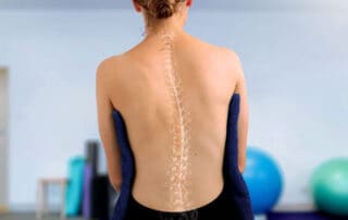 The Psychological Impact of Scoliosis