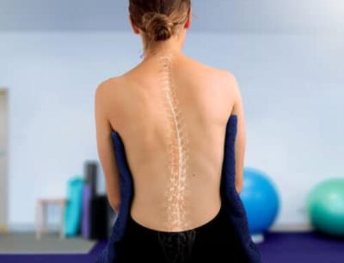 The Psychological Impact of Scoliosis: Navigating the Emotional Terrain