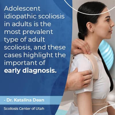Adolescent idiopathic scoliosis in adults is the most prevalent type of adult scoliosis, and these cases highlight the importance of early detection.