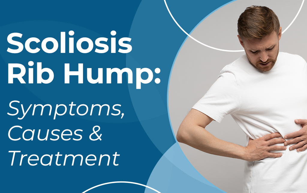 A featured image post for the blog titled: “Scoliosis Rib Hump: Symptoms, Causes & Treatment"
